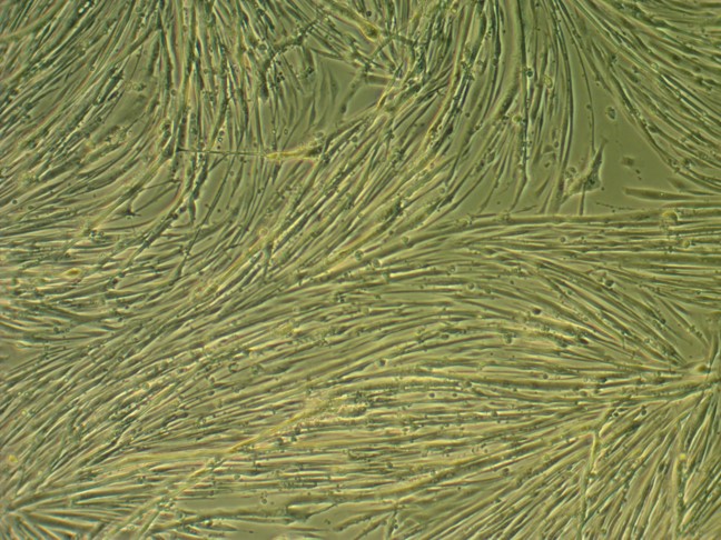 myotubes_primaires_souris.jpg